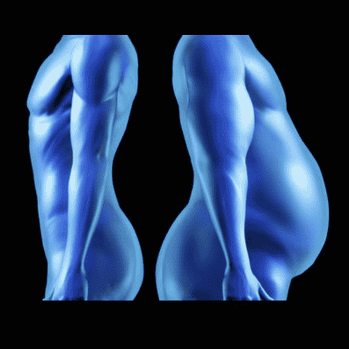 Cirugía de plicatura de manga gástrica (LGCP) más efectiva en México