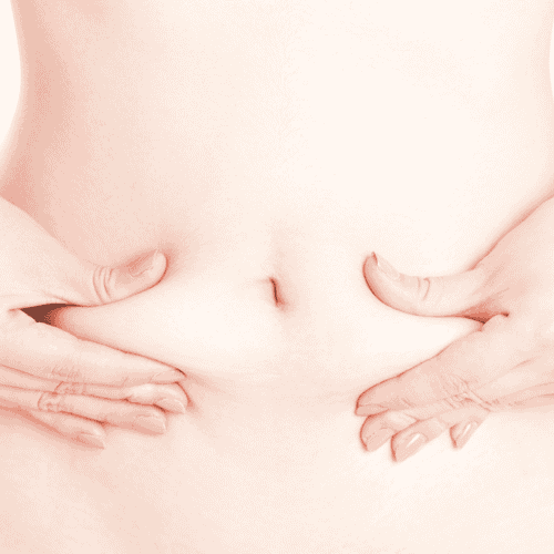 Liposucción en Los Algodones, México por Baja Surgery Center