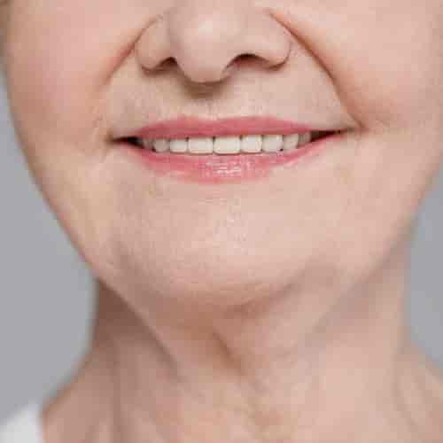 Paquete de restauración de boca completa en Los Algodones, México por ALL on X