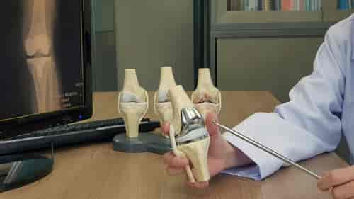  Paquete de tratamiento de reemplazo total de rodilla (TKR)