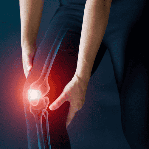 Células Madre República Dominicana: Tratamiento de la Osteoartritis por el Dr. Vargas Decamps en Santo Domingo