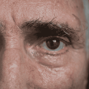 Terapia innovadora con células vivas para la retinosis pigmentaria en México