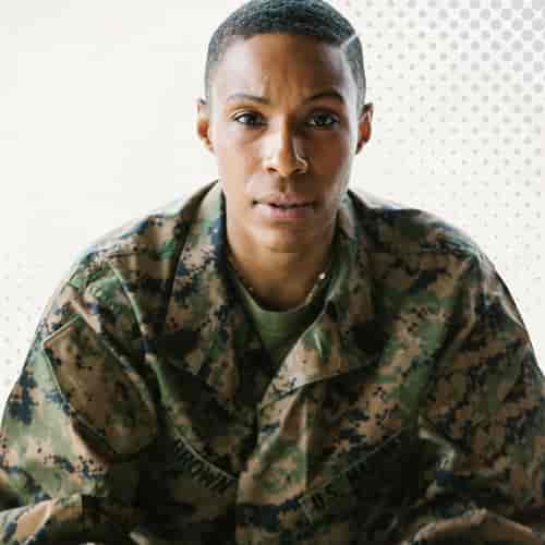 Paquete de lifting de cuello por el Dr. Sealtiel Machuca en Tijuana, México