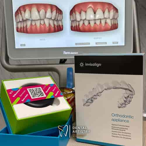 Paquete Invisalign en Nuevo Progreso, México por Dental Artistry y World Dental Center