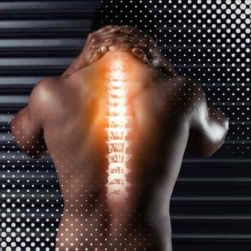 Paquete de Terapia con Células Madre para Hernias Discales en Santo Domingo, República Dominicana, por el Dr. Vargas Decamps