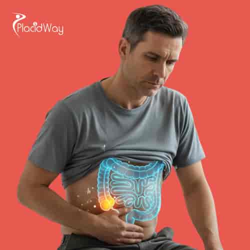 Paquete de tratamiento alternativo para el cáncer de colon en Tijuana, México, por Immunity Therapy Center