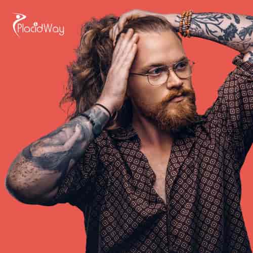 Tratamiento con células madre para la caída del cabello en Cabo San Lucas, México