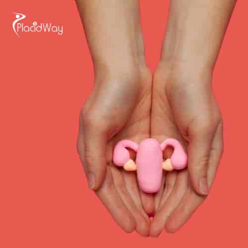 Paquete de tratamiento alternativo para el cáncer de ovario en Tijuana, México, ofrecido por ITC.