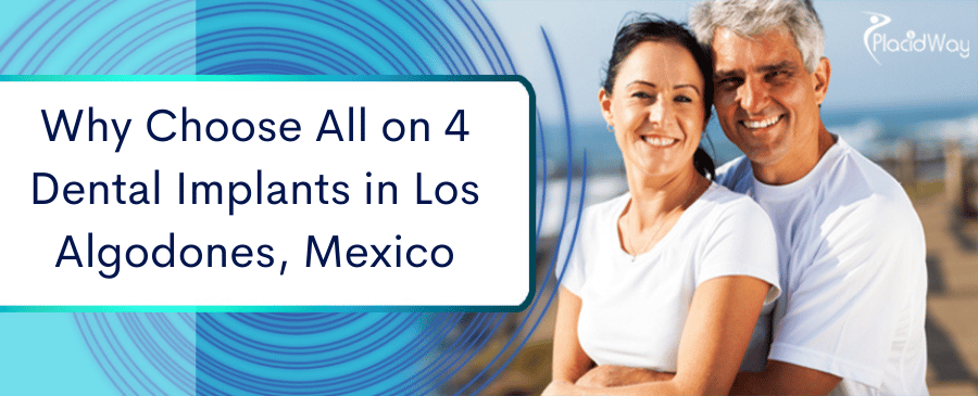 Todo sobre 4 Implantes Dentales en Los Algodones, México 