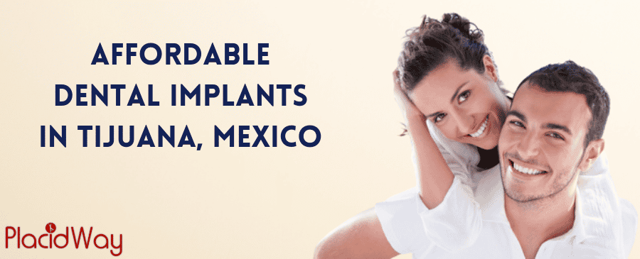 Implantes dentales asequibles en Tijuana, México