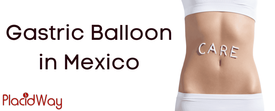 Balón Gástrico en México