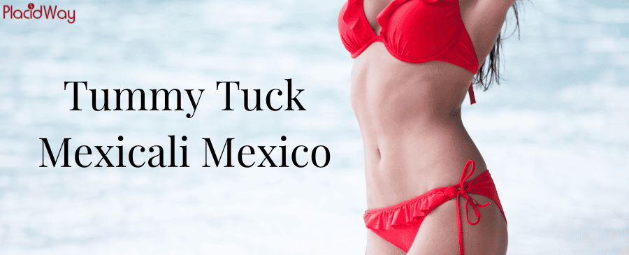 Abdominoplastia en Mexicali, México