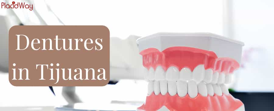 Dentaduras postizas en Tijuana