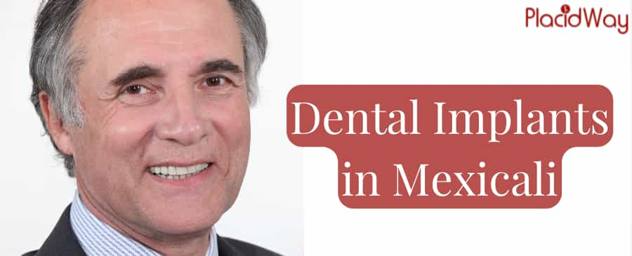 Implantes Dentales en Mexicali, Paquete, Costo, Clinicas, Opiniones