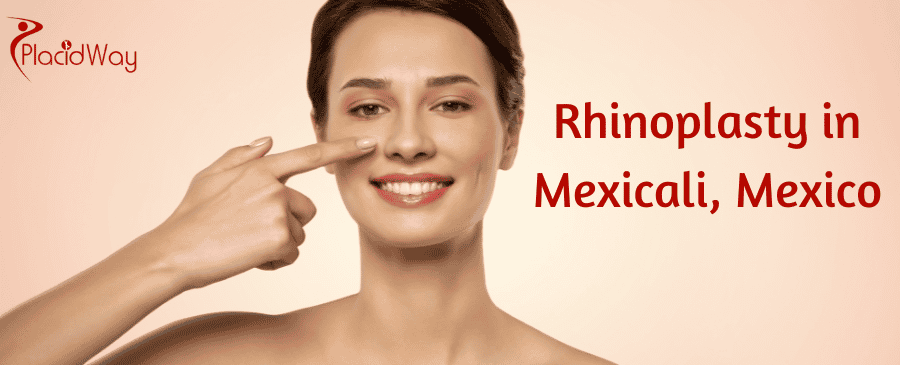 Rinoplastia en Mexicali, México