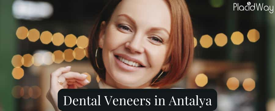 Carillas dentales en Antalya