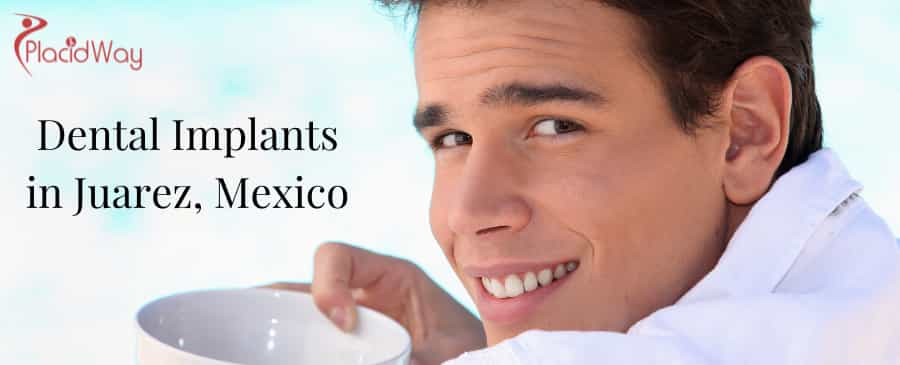 Implantes dentales en Juárez