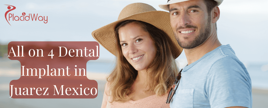 Implantes dentales All on 4 en Juárez México