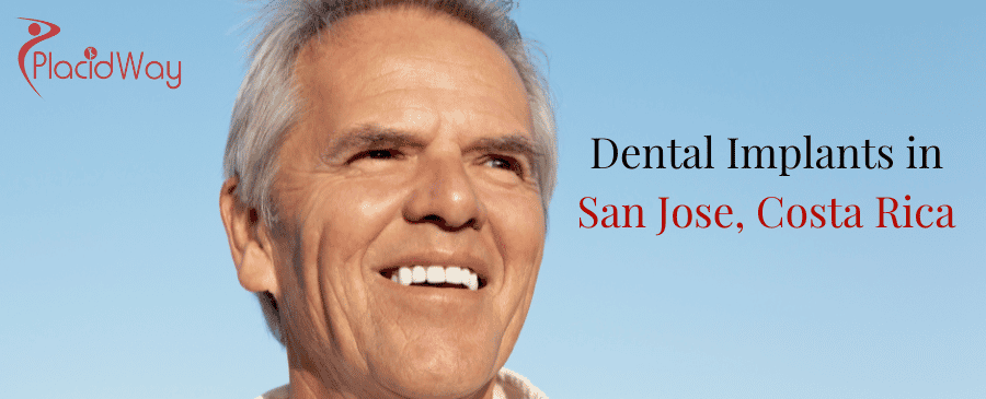 Implantes dentales en San José, Costa Rica