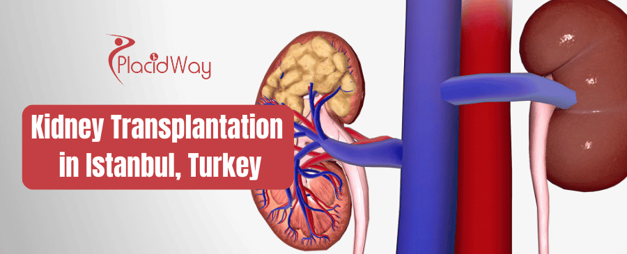 Trasplante de riñón en Estambul, Turquía