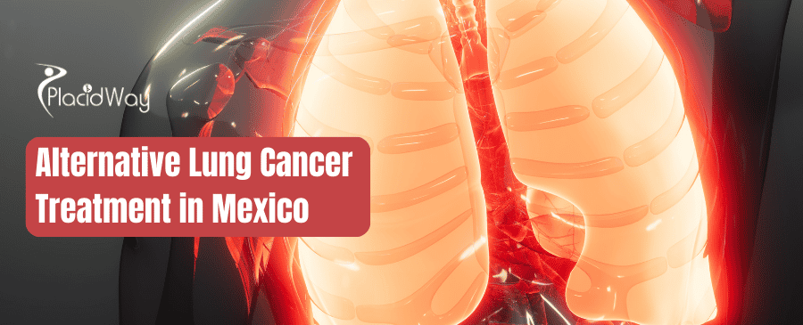 Tratamiento alternativo del cáncer de pulmón en México