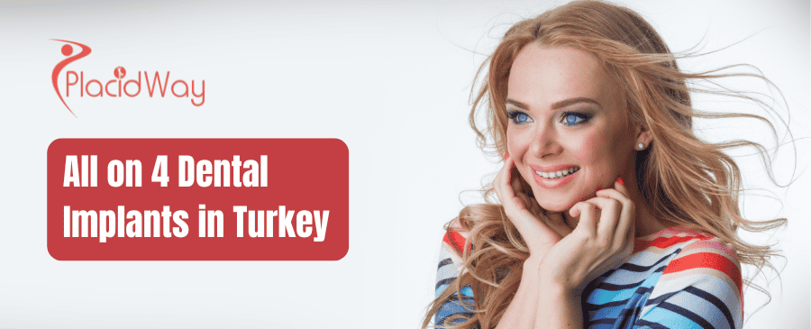 Implantes dentales All on 4 en Turquía