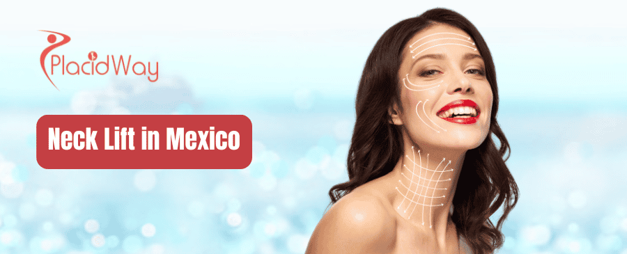 Lifting de cuello en México