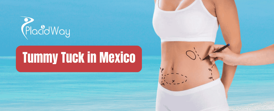 Abdominoplastia en México