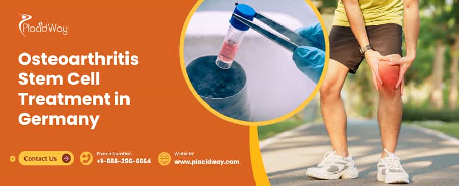 Tratamiento con células madre para la osteoartritis en Alemania thumbnail