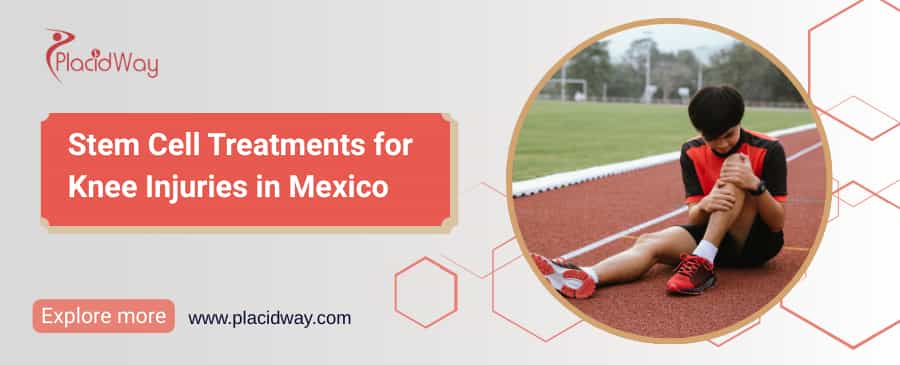 Terapia con células madre para la rodilla en México thumbnail