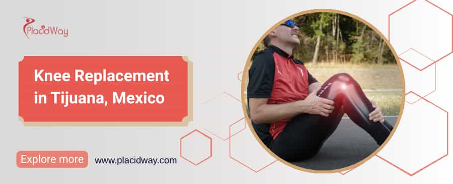 Reemplazo de Rodilla en Tijuana - Recupere la Salud de sus Rodillas thumbnail