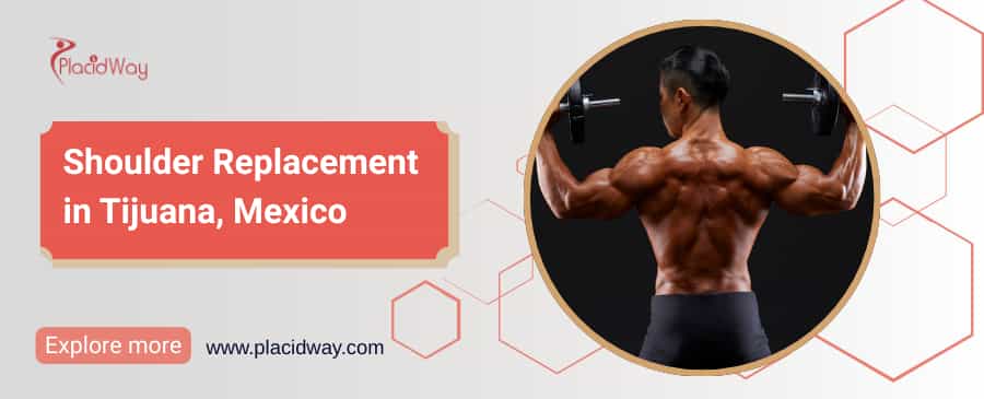 Reemplazo de hombro en Tijuana, México thumbnail