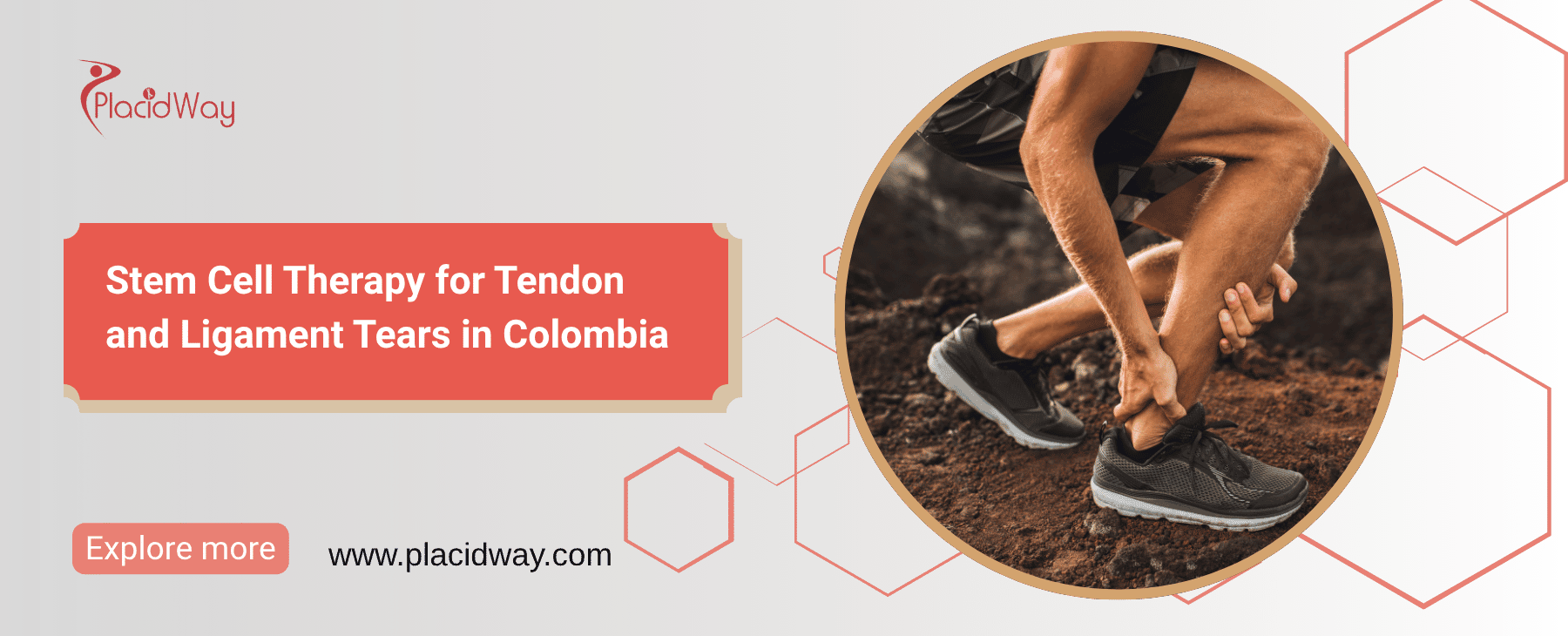 Terapia con células madre para desgarros de tendones y ligamentos en Colombia thumbnail