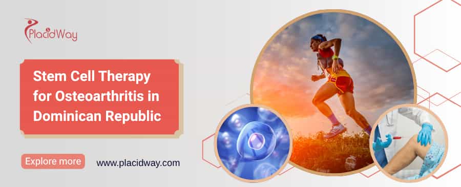 Terapia con células madre para la osteoartritis en República Dominicana thumbnail
