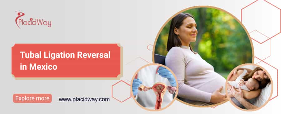 Reversión de la ligadura de trompas en México: método eficaz para dar a luz thumbnail