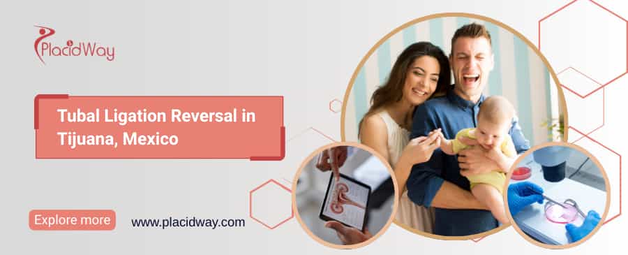Reversión de ligadura de trompas en Tijuana, México thumbnail