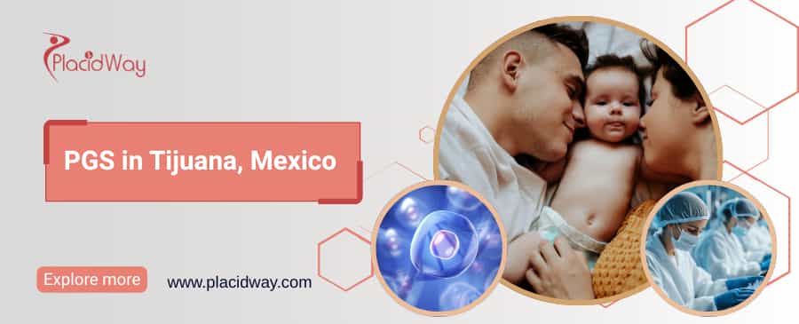 PGS en Tijuana, México thumbnail