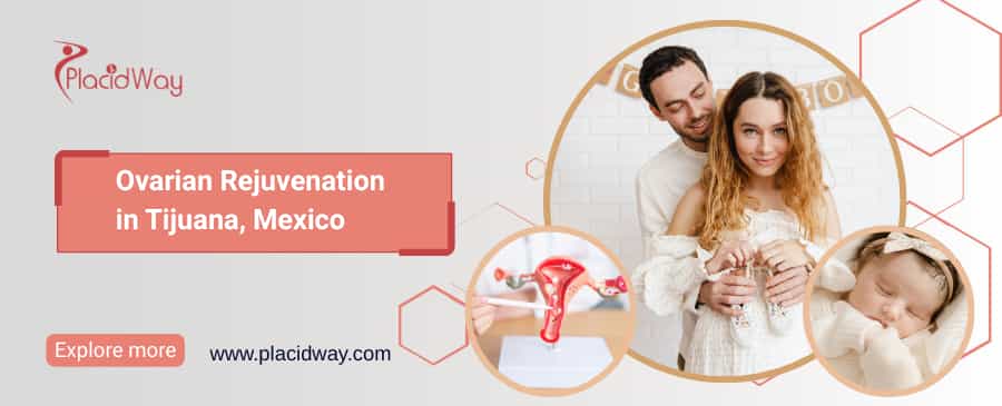 Rejuvenecimiento ovárico en Tijuana, México thumbnail