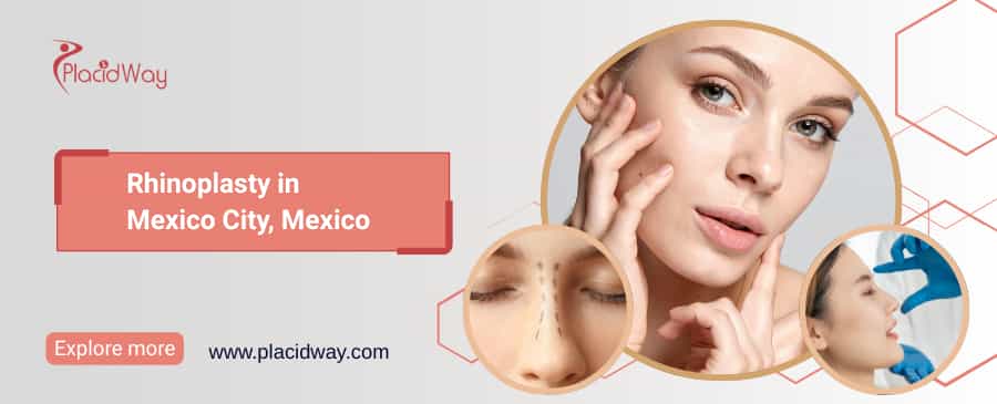 Rinoplastia en la Ciudad de México, México thumbnail