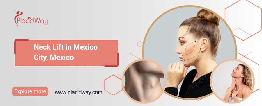 Lifting de cuello en la Ciudad de México, México thumbnail