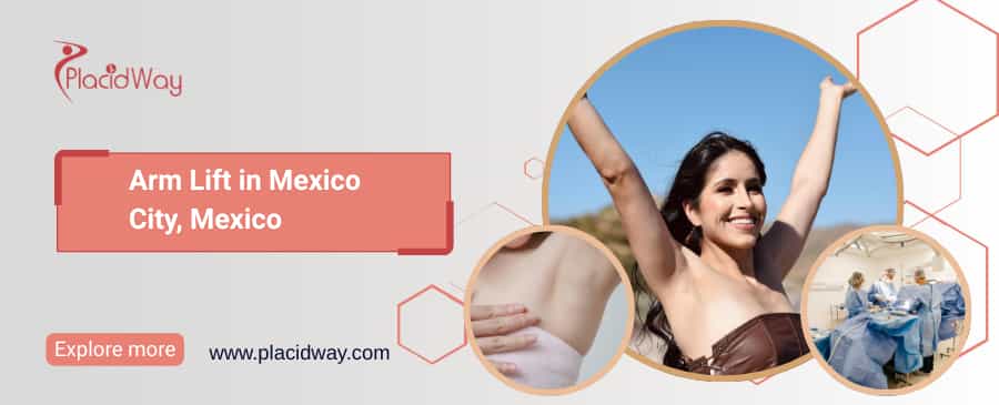 Lifting de brazos en la Ciudad de México, México thumbnail