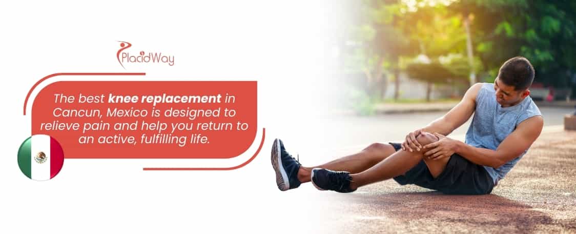 El mejor reemplazo de rodilla en Cancún, México, en un hospital de primera categoría thumbnail