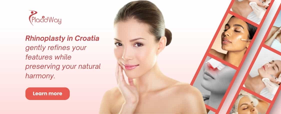 Rinoplastia en Croacia thumbnail
