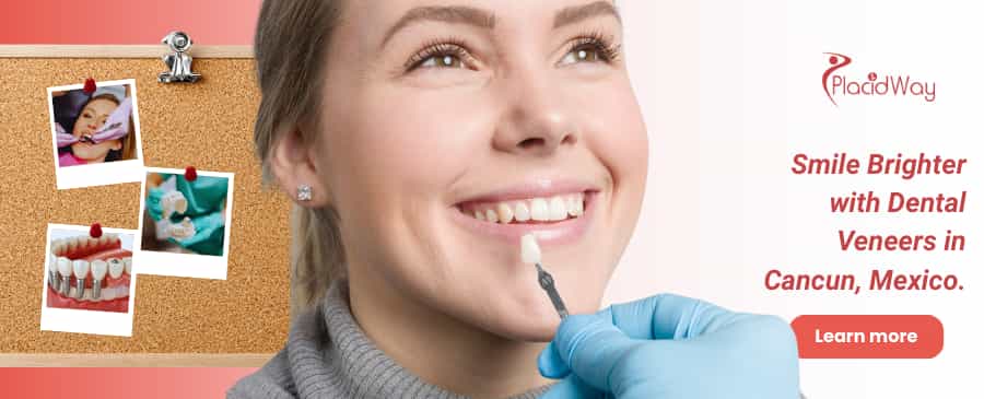 Carillas dentales en Cancún, México thumbnail