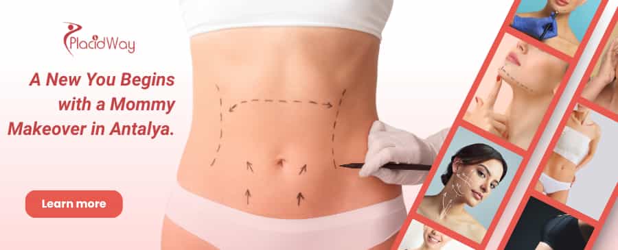 Cambio de imagen para mamás en Antalya, Turquía thumbnail