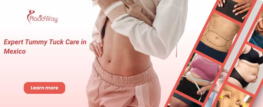 Abdominoplastia en Tijuana México – ¡Mejora la forma de tu cuerpo! thumbnail