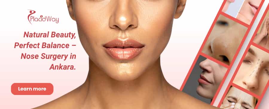 Rinoplastia en Ankara, Turquía thumbnail