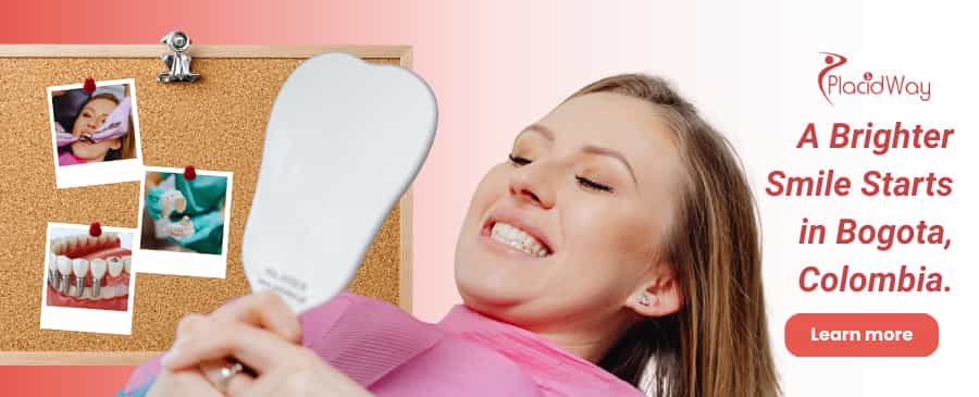Carillas dentales en Bogotá Colombia thumbnail
