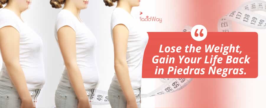 Cirugía de Manga Gástrica en Piedras Negras, México thumbnail