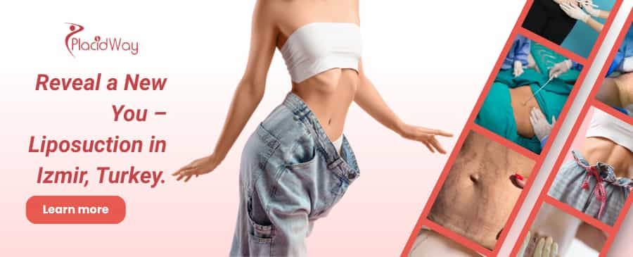 Liposucción en Izmir, Turquía thumbnail
